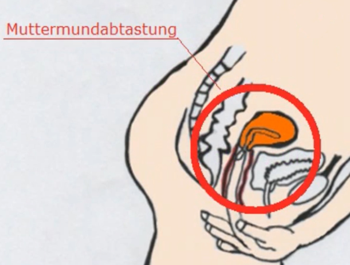 wie Muttermund abtasten